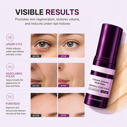 Ashthera Calcium Multi Balm